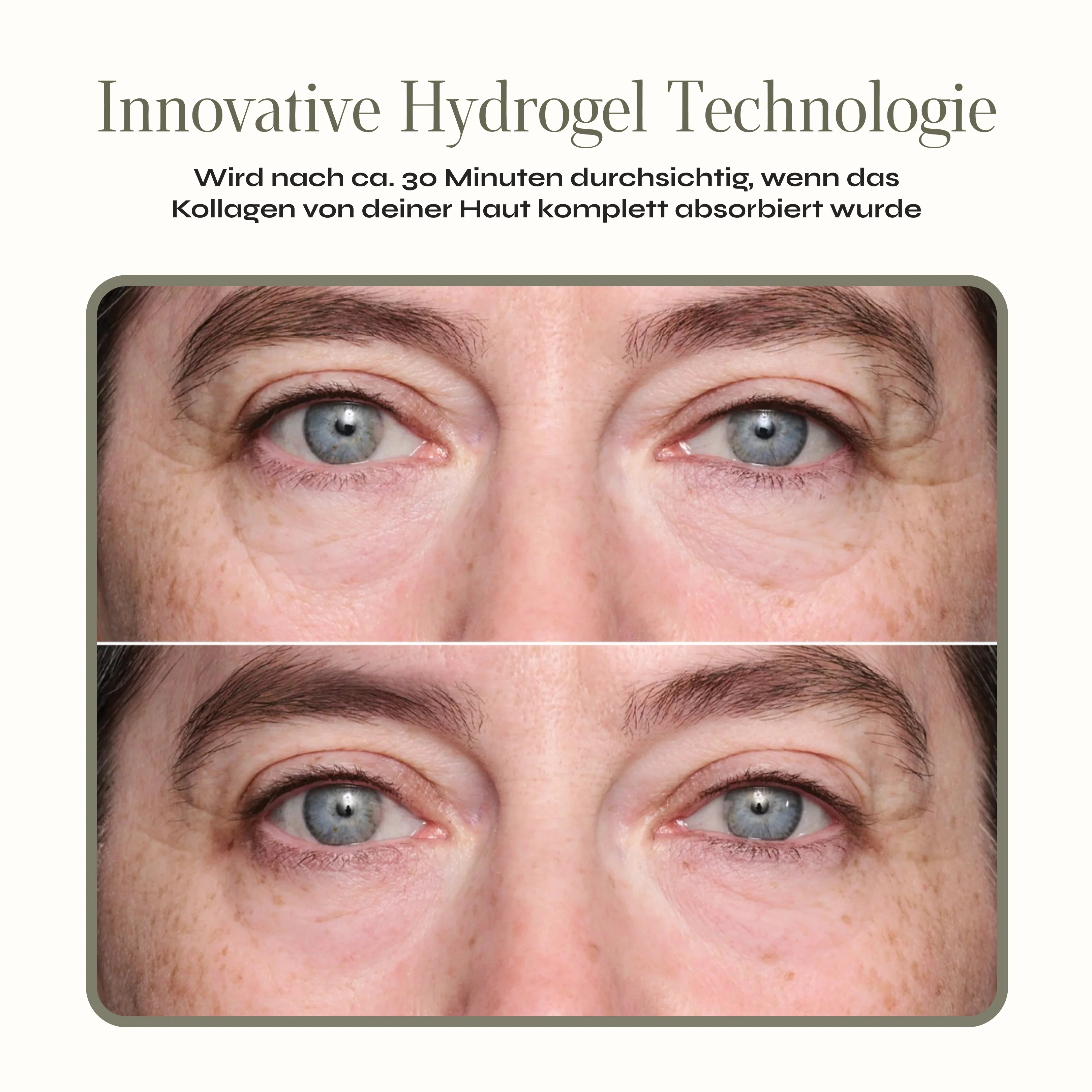 Kollagen Augen Patches - Image 3