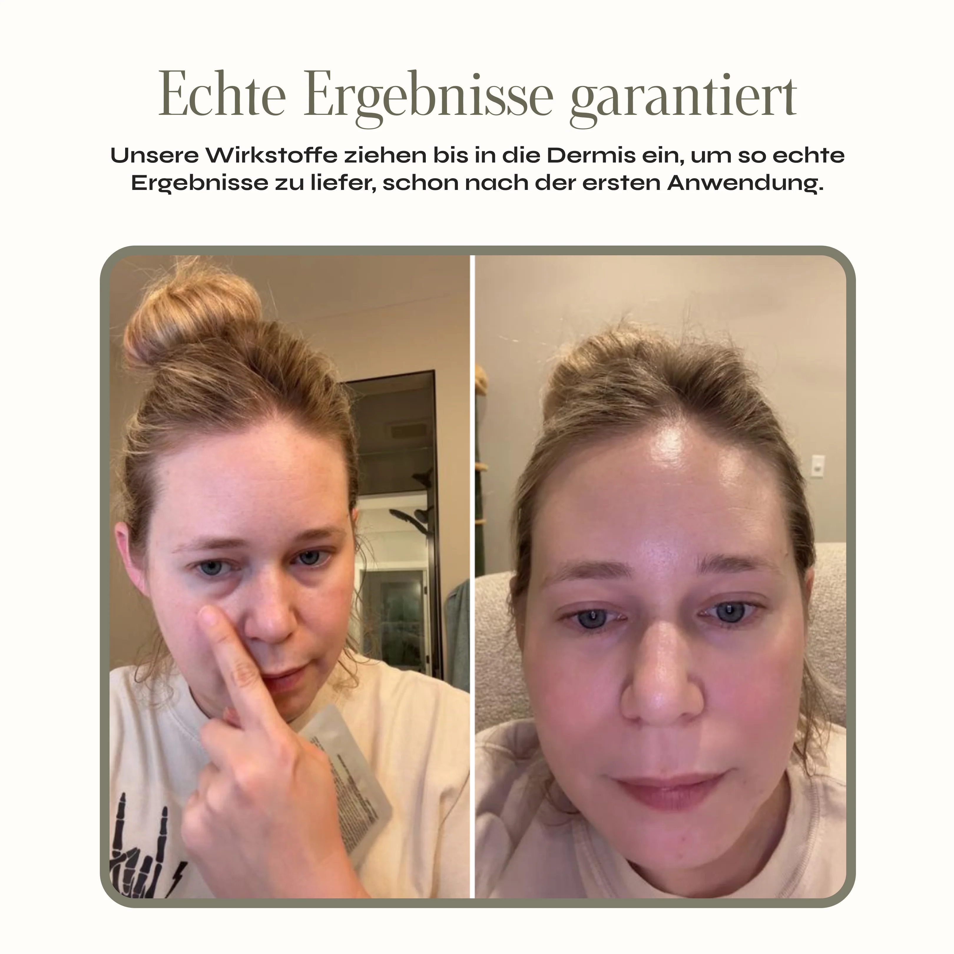 Kollagen Augen Patches - Image 6