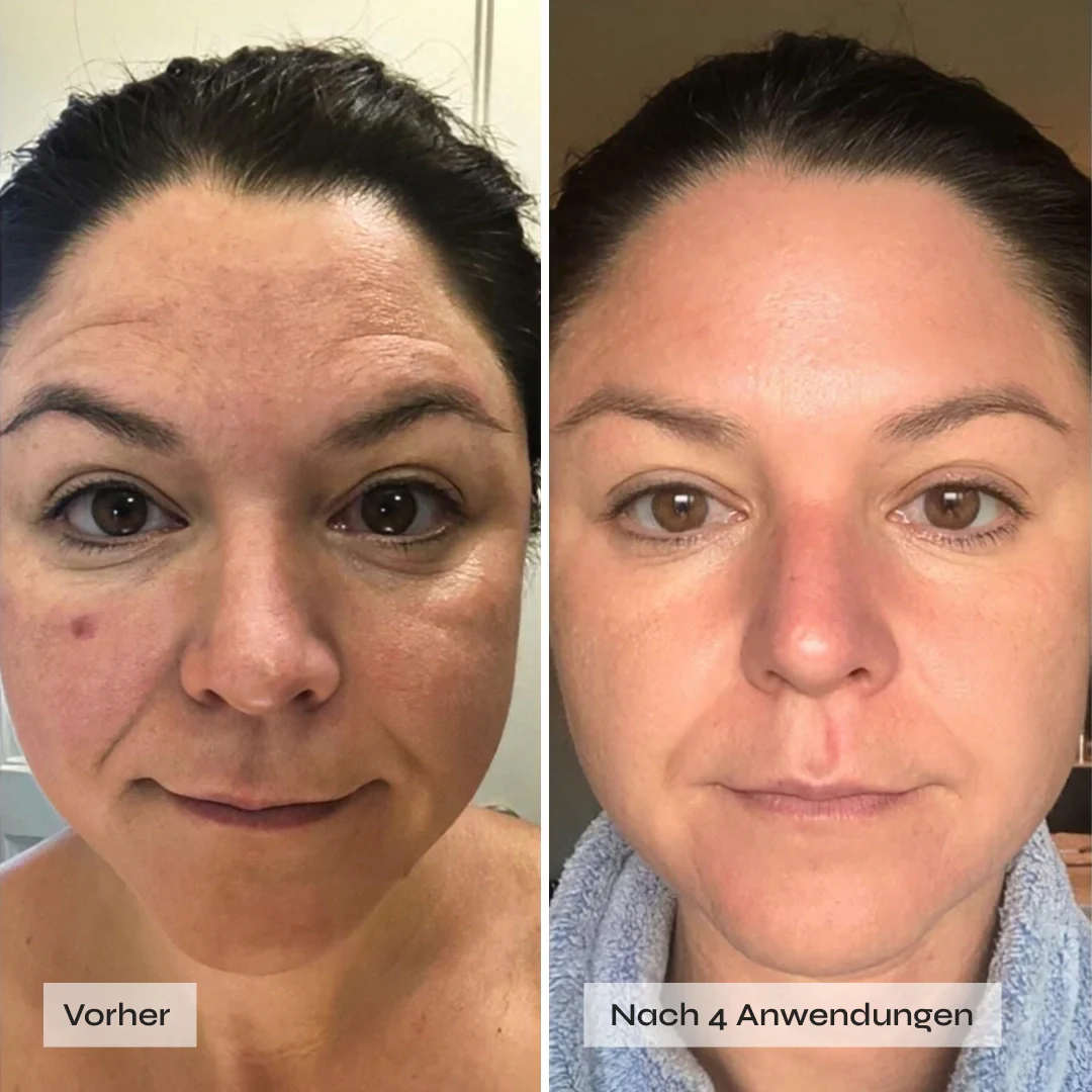 Kollagen Boosting Maske - Image 4