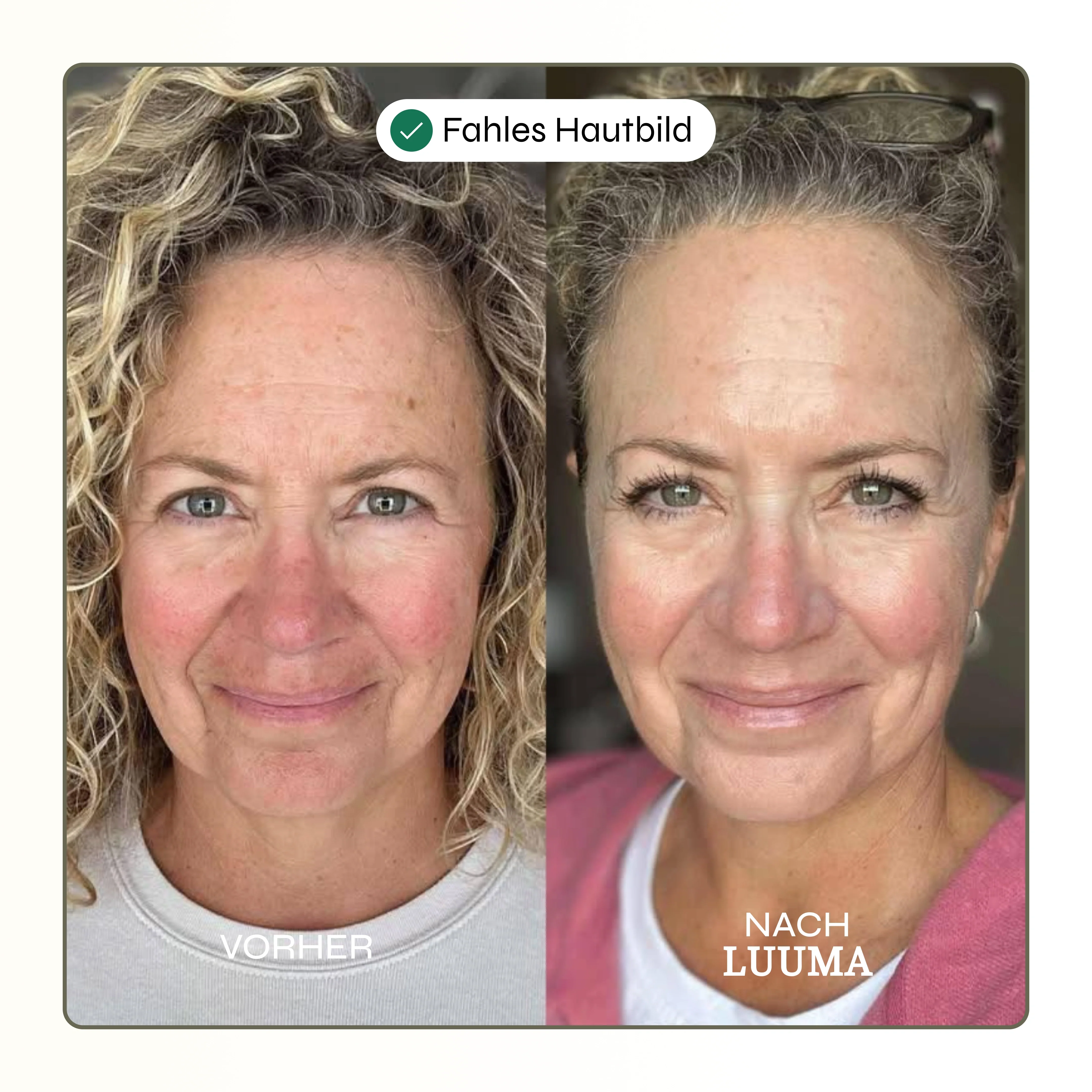 Kollagen Glow Maske - Image 3