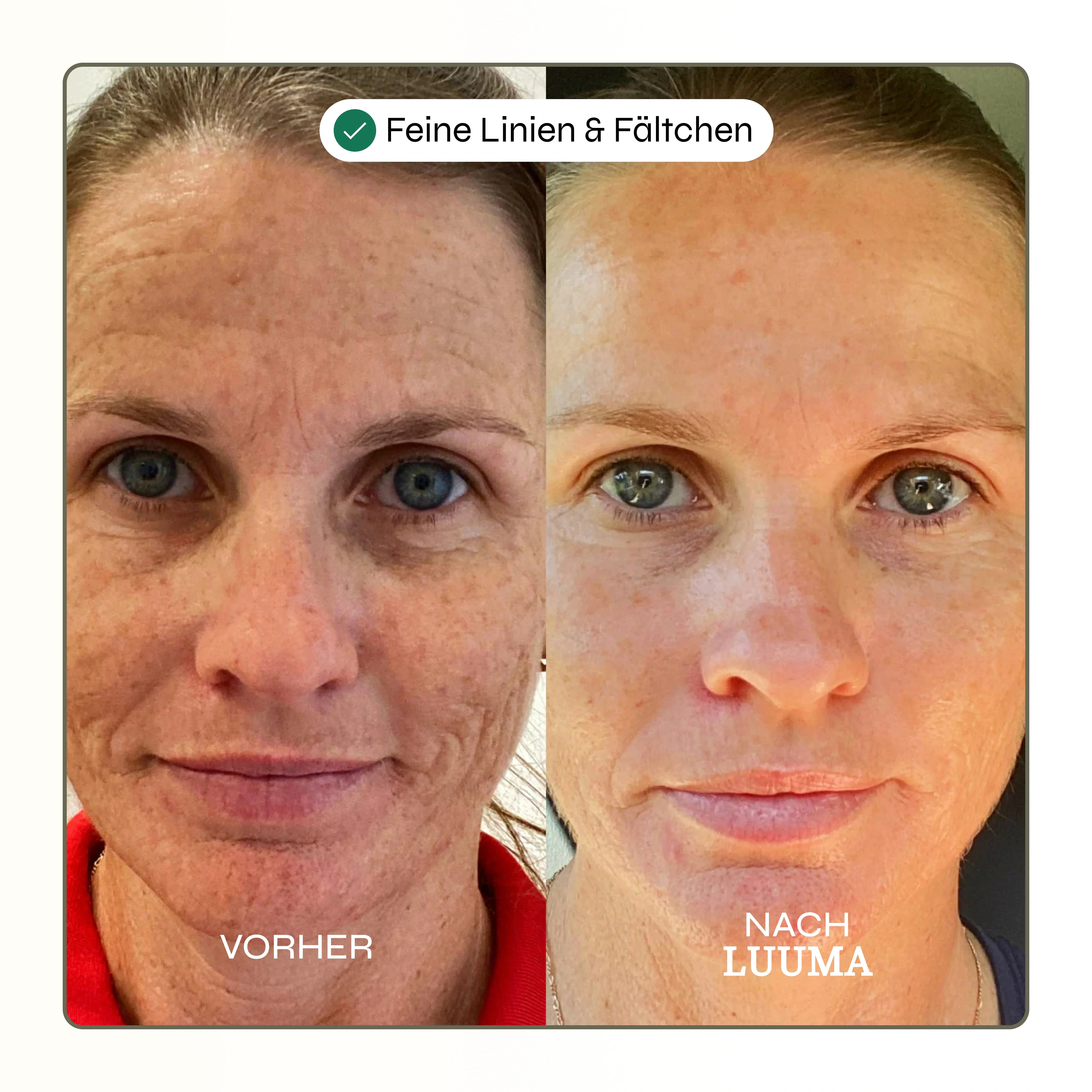 Kollagen Glow Maske - Image 4