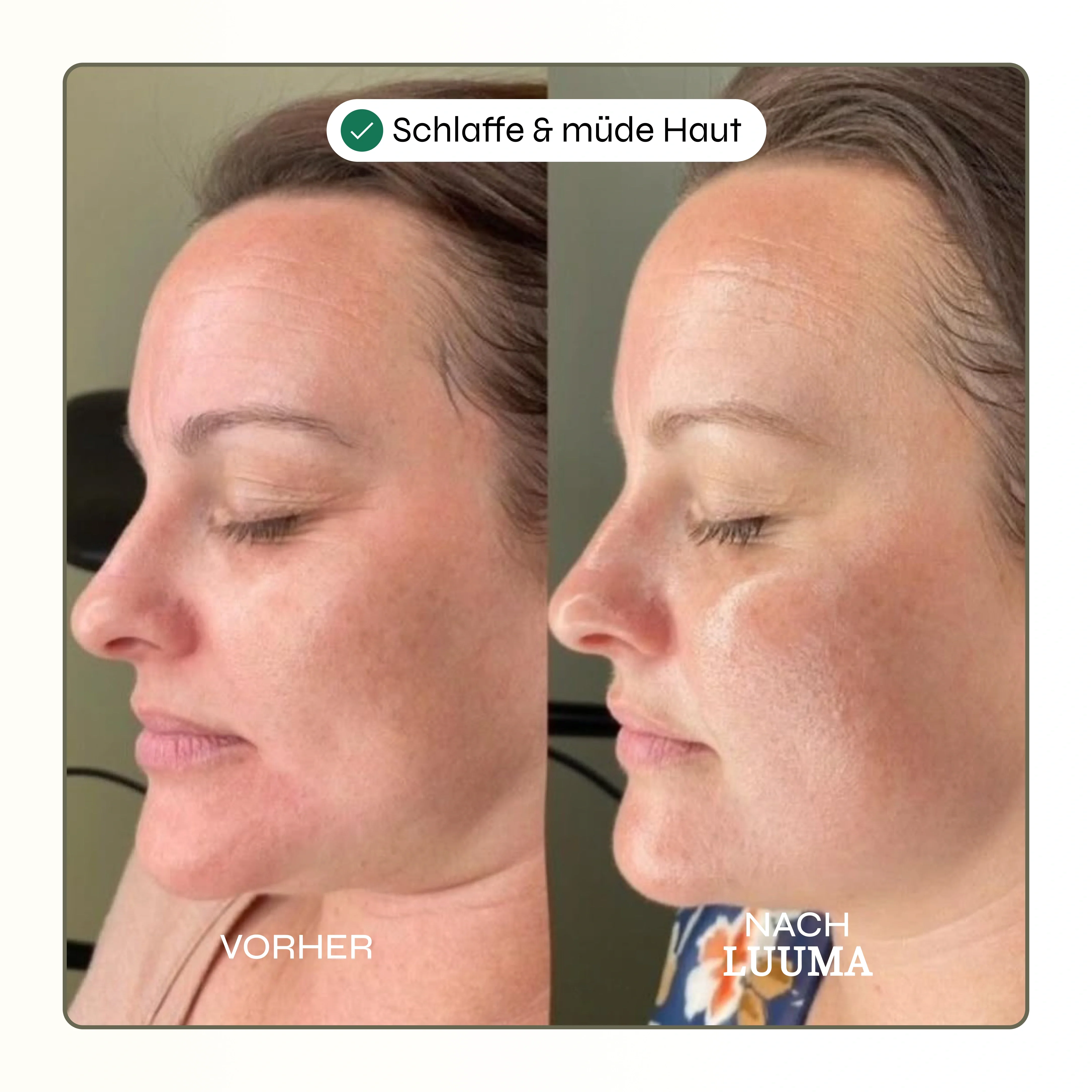 Kollagen Glow Maske - Image 5