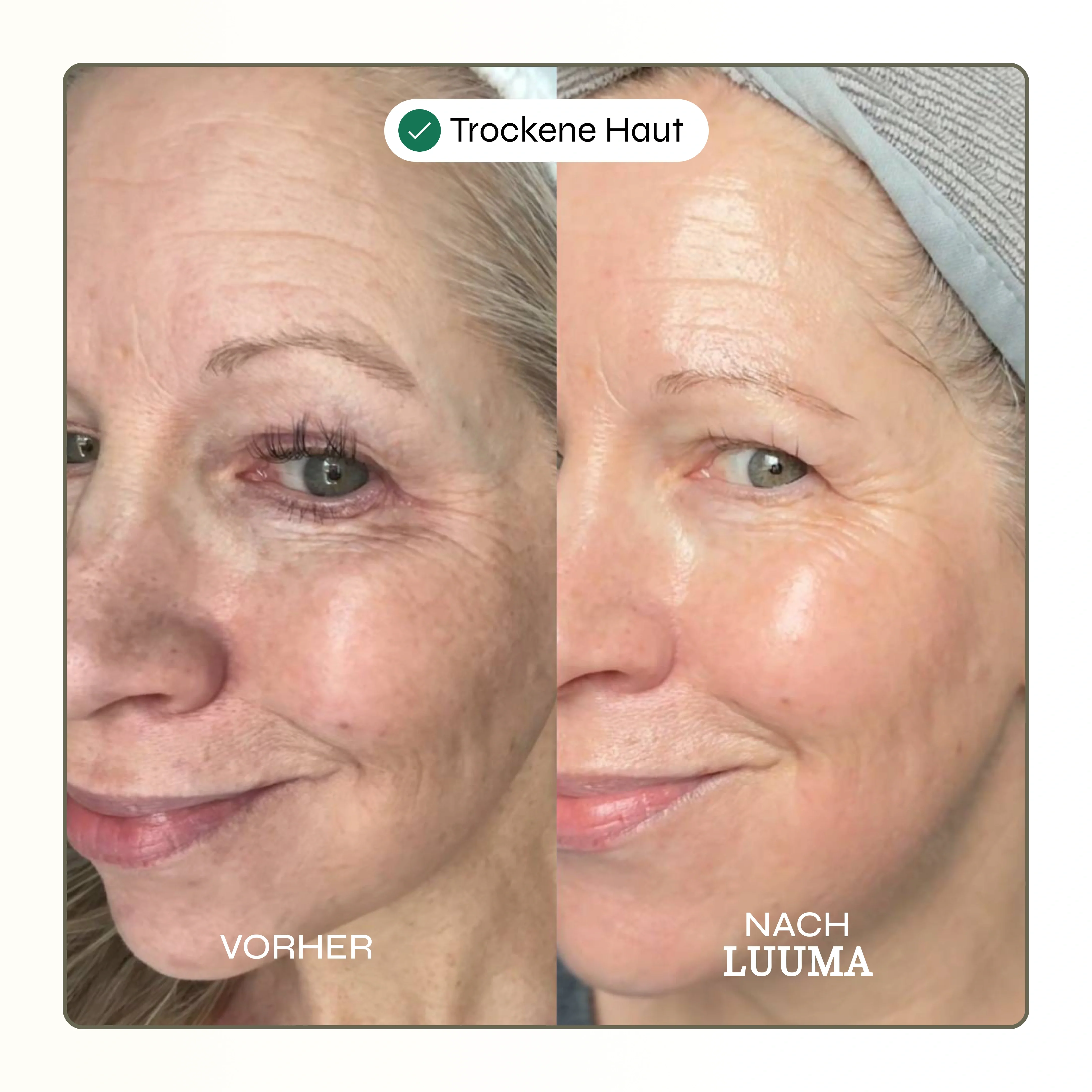 Kollagen Glow Maske - Image 6