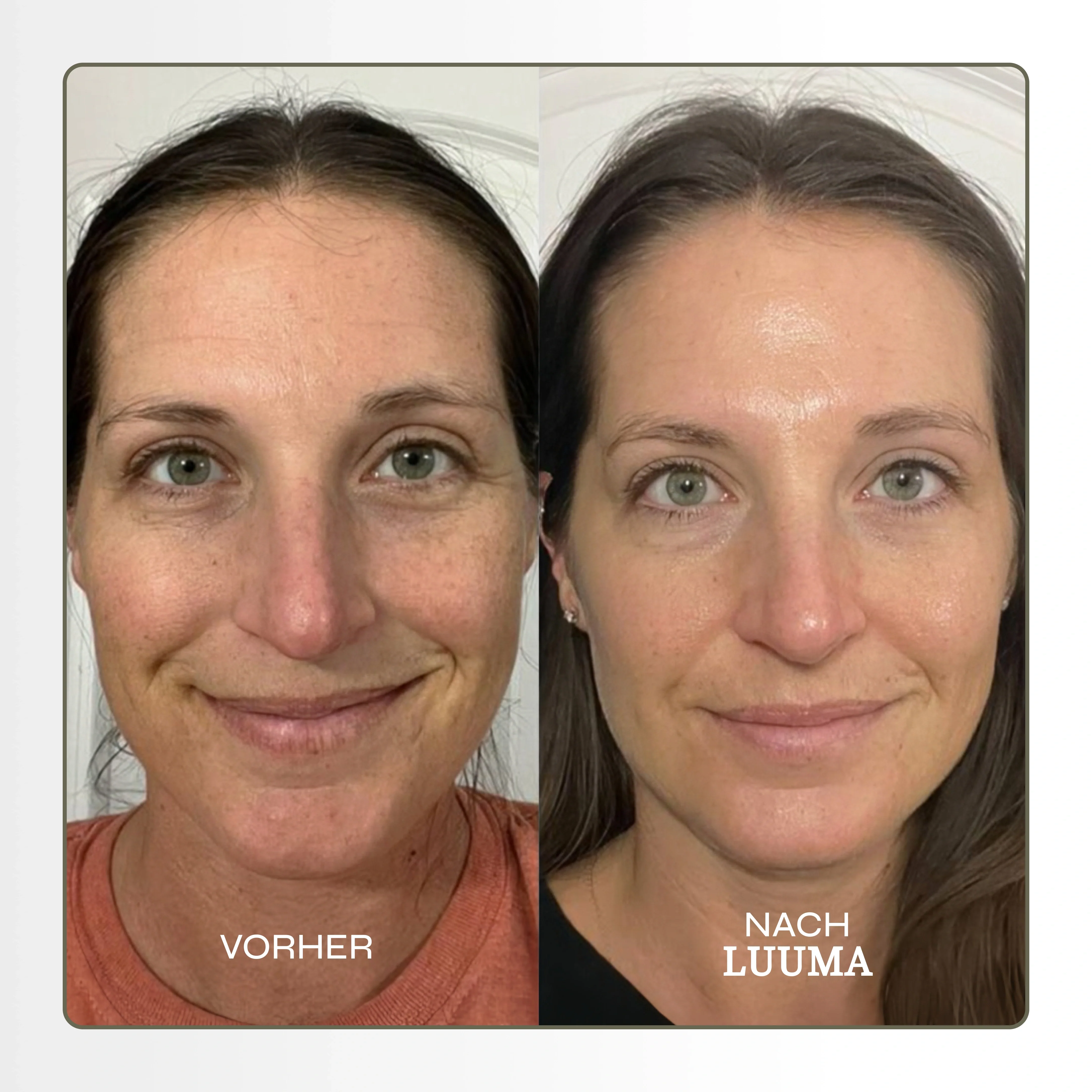 Mikro Infusions Kit - Image 3